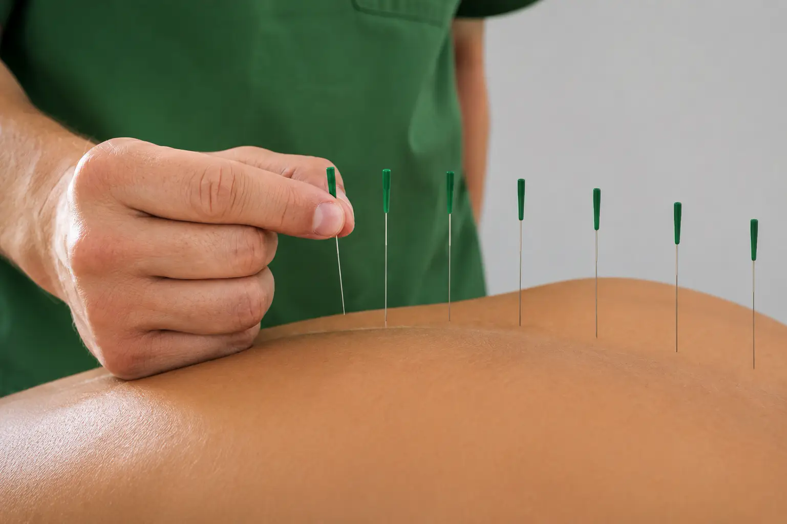 Dry Needling